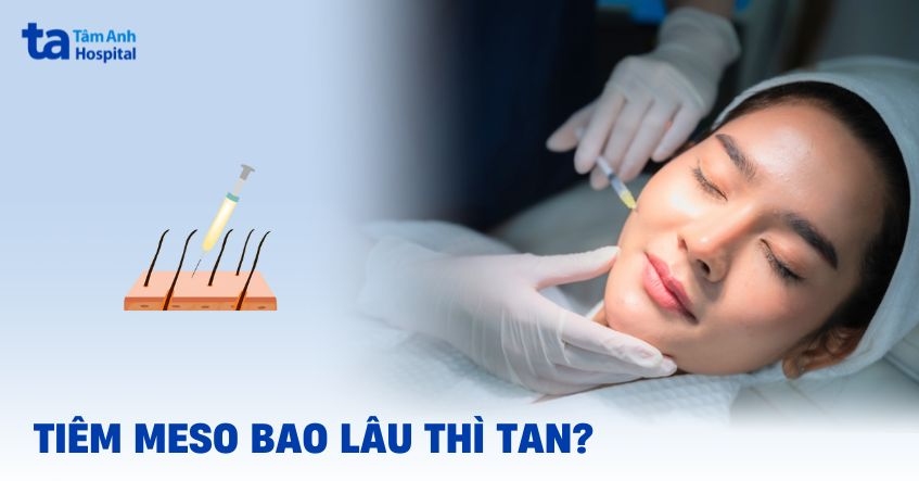 tiêm meso bao lâu thì tan