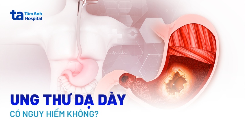 ung thư dạ dày có nguy hiểm không