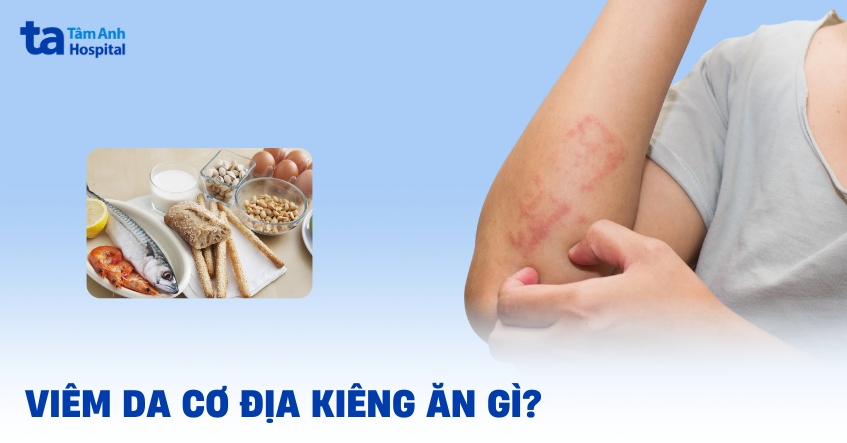 viêm da cơ địa kiêng ăn gì