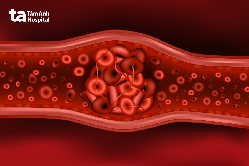 prothrombin kích hoạt tiểu cầu