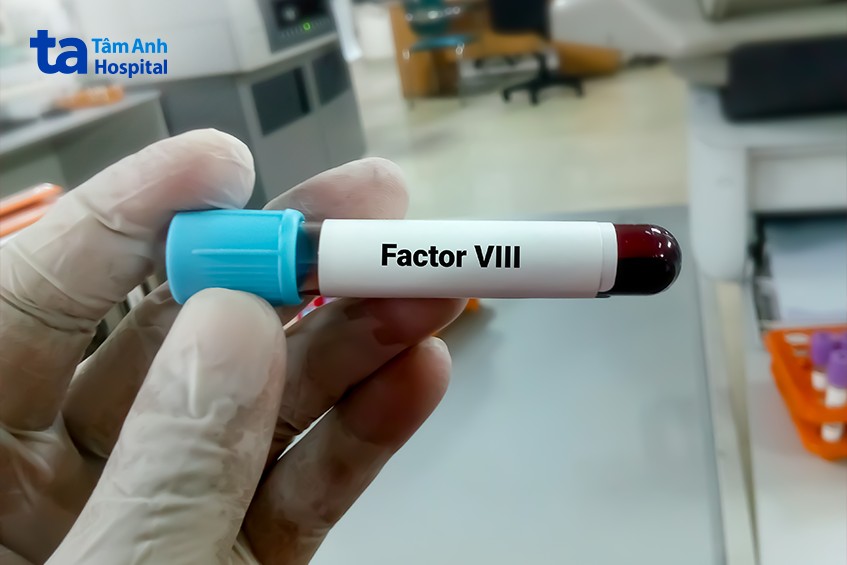 yếu tố viii đẩy nhanh quá trình chuyển đổi
