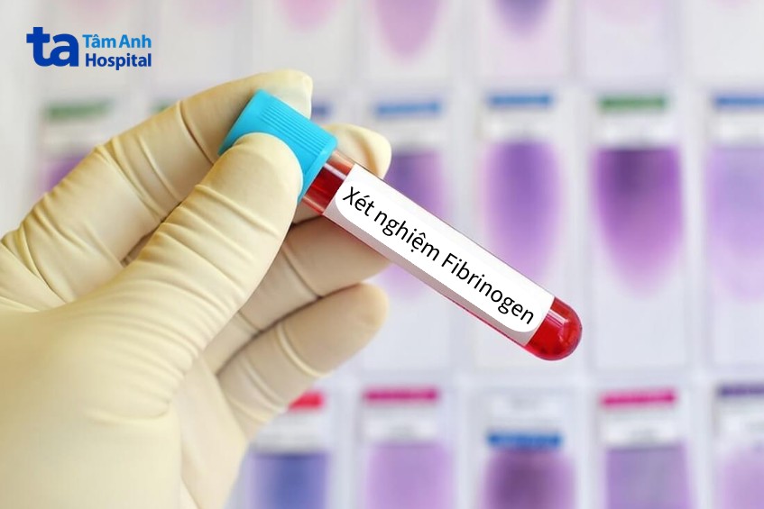 xét nghiệm fibrinogen trong máu