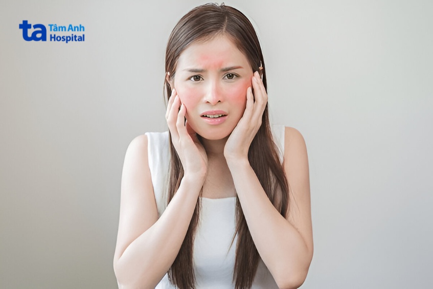 hình ảnh viêm da cơ địa ở mặt người lớn