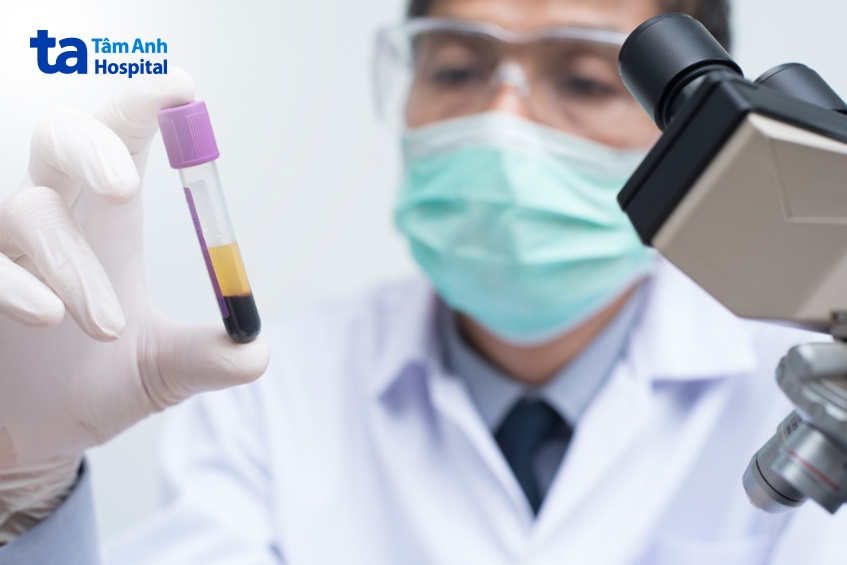 xét nghiệm máu chẩn đoán bệnh ung thư