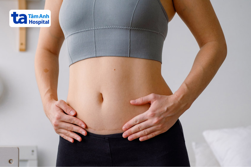 điều nhiều chị em quan tâm