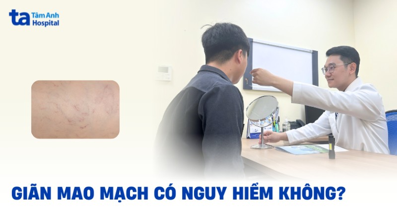 giãn mao mạch có nguy hiểm không