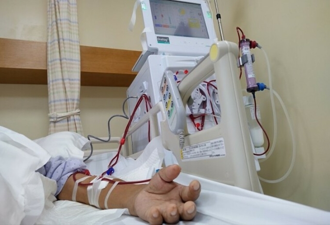 Một bệnh nhân đang chạy thận nhân tạo. Ảnh: Đinh Tiên