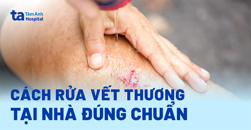 rua-vet-thuong-tai-nha-dung-chuan