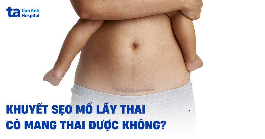 khuyết sẹo mổ lấy thai có mang thai được không