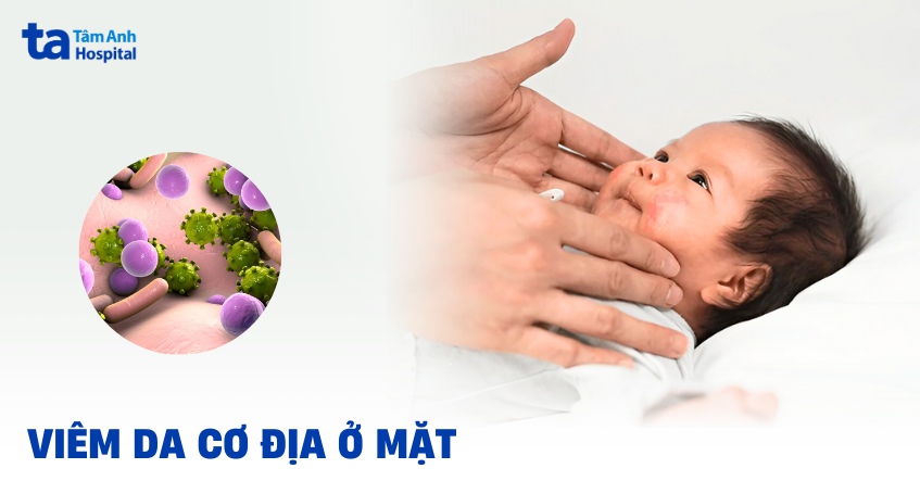 viêm da cơ địa ở mặt