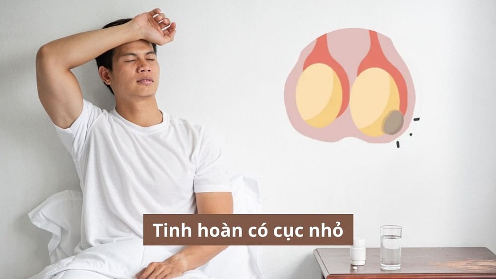 Tinh hoàn có cục nhỏ