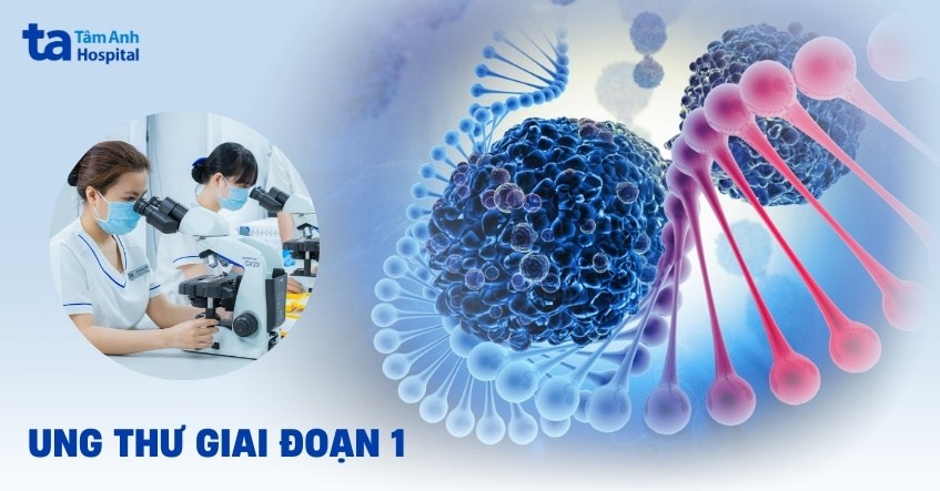 ung thư giai đoạn 1