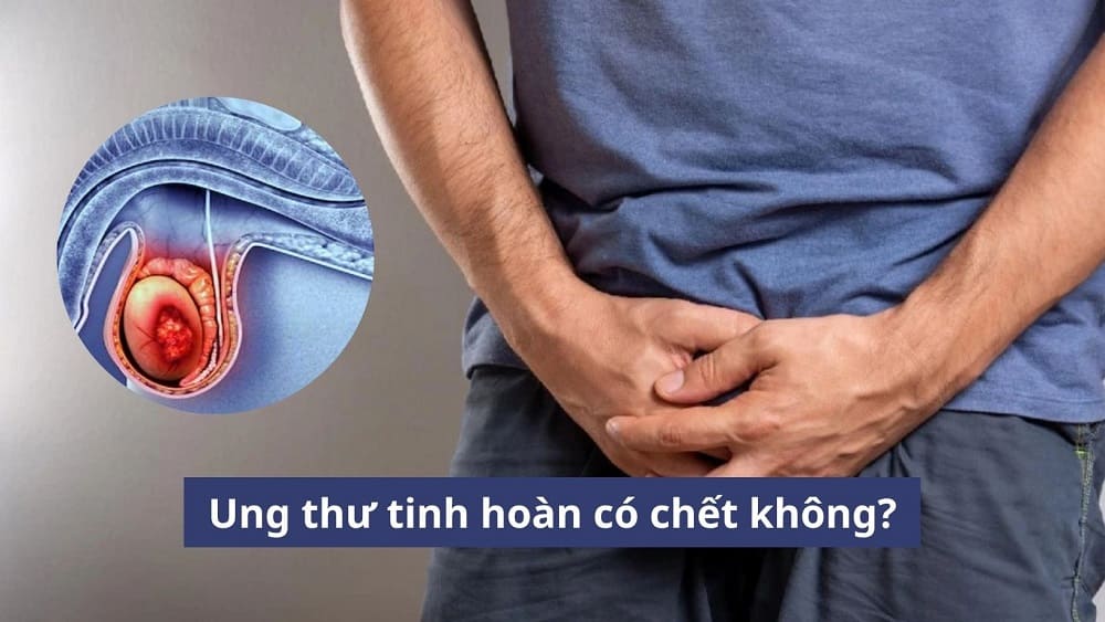 Ung thư tinh hoàn có chết không?